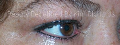Right Eye - Post Eyeliner Application