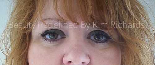 Eyeshadow: Post Eyeshadow Eyeliner 3 Months Healed