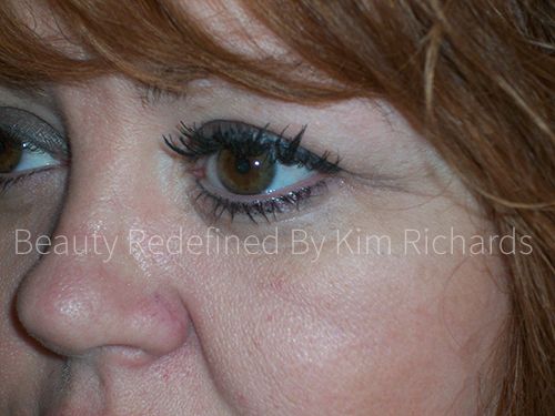 Eyeshadow: Post Left Eye Eyeshadow & Eyeliner 3 Months Healed